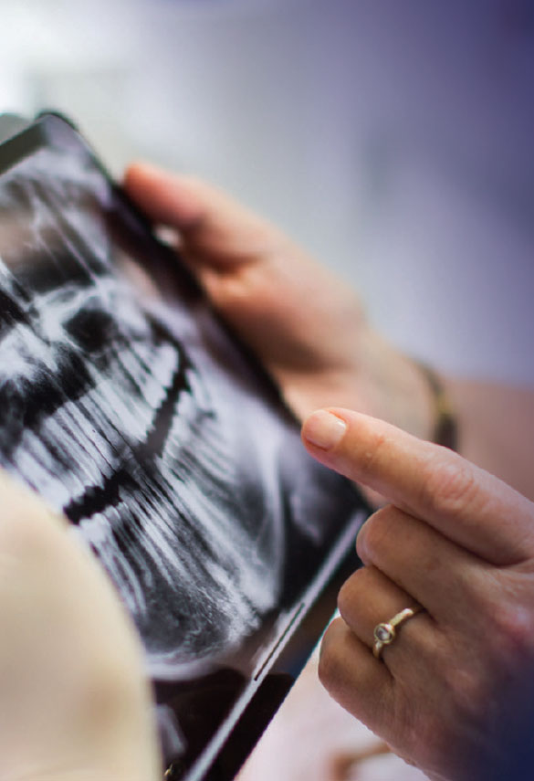 Hands holding tablet device looking at xray of teeth