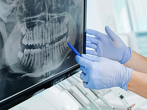 A doctor explaining an dental X-ray scan 